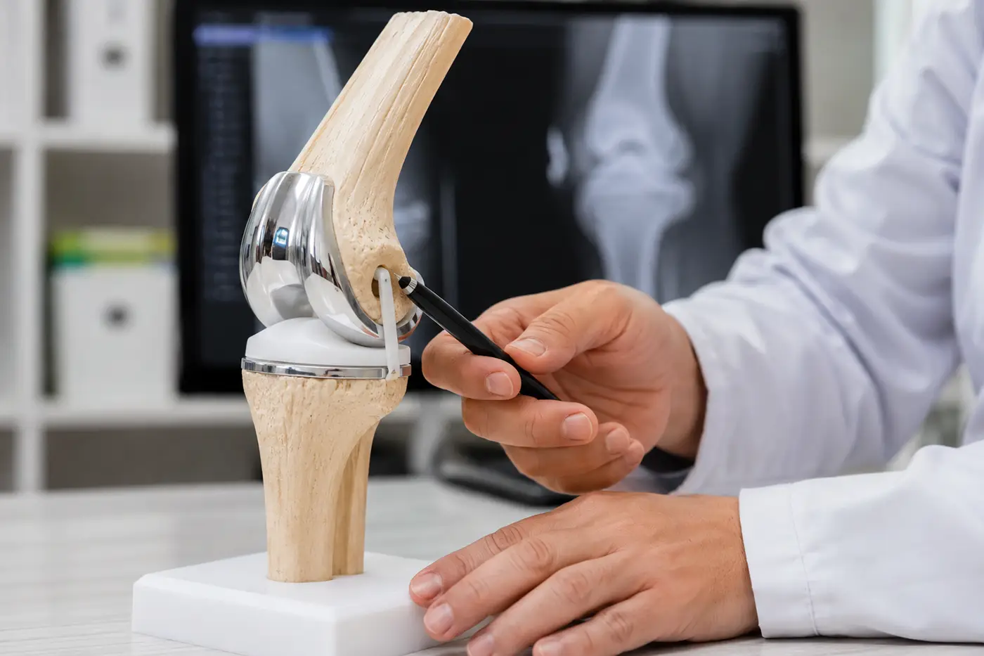 Prótesis Articular